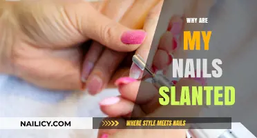 Why Are My Nails Slanted? Causes and Solutions Explained
