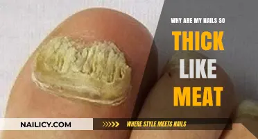 Thick Nails Explained: Causes and Solutions for Meat-Like Nail Texture