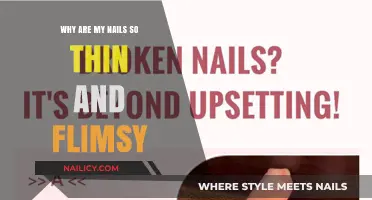 Why Are My Nails So Thin and Flimsy? Causes and Solutions