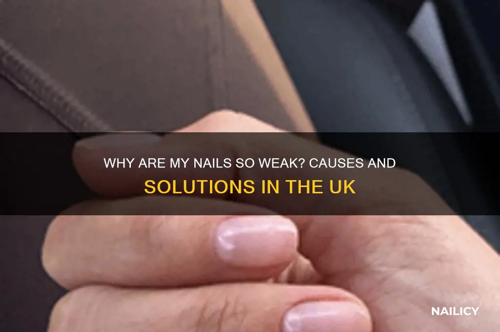 why are my nails so weak uk