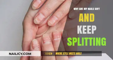 Soft, Splitting Nails? Causes and Solutions for Brittle Manicures
