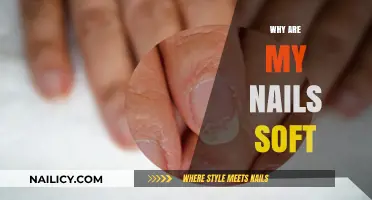 Why Are My Nails Soft? Causes and Solutions for Weak Nails