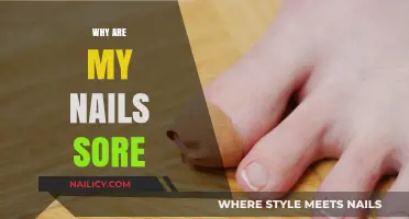 Why Are My Nails Sore? Causes, Remedies, and Prevention Tips