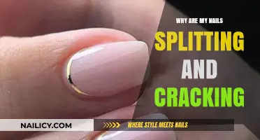 Why Are My Nails Splitting and Cracking? Causes and Solutions