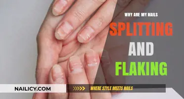 Why Are My Nails Splitting and Flaking? Causes and Solutions