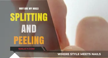 Why Are My Nails Splitting and Peeling? Causes and Solutions