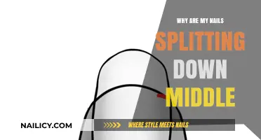 Why Are My Nails Splitting Down the Middle? Causes & Solutions