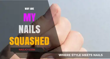 Squashed Nails? Causes and Solutions for Flattened Nail Beds