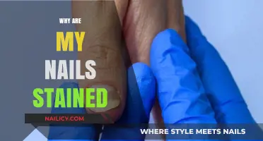 Why Are My Nails Stained? Causes and Solutions for Discolored Nails