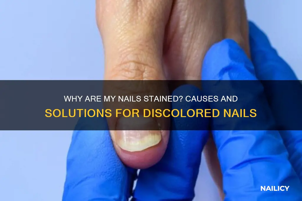 why are my nails stained