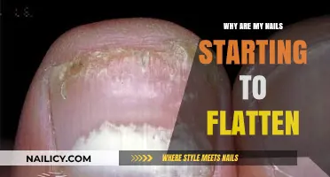 Why Are My Nails Flattening? Causes and Solutions Explained