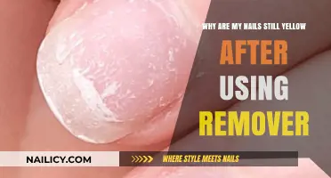 How to Remove Nail Polish Stains?