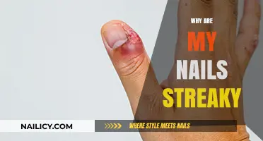 Streaky Nails Explained: Causes and Solutions for Uneven Nail Color