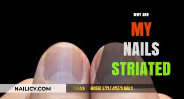 Why Are My Nails Striated? Causes and Solutions Explained