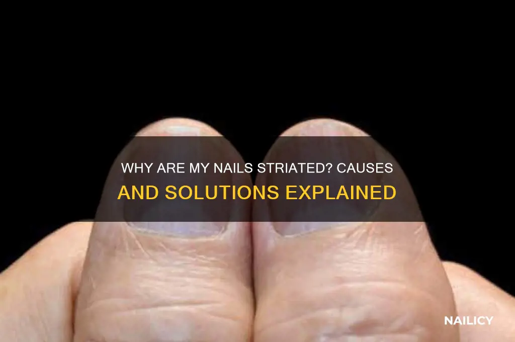why are my nails striated