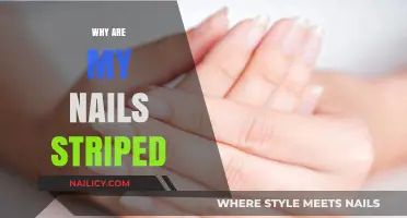 Why Are My Nails Striped? Causes and Solutions Explained