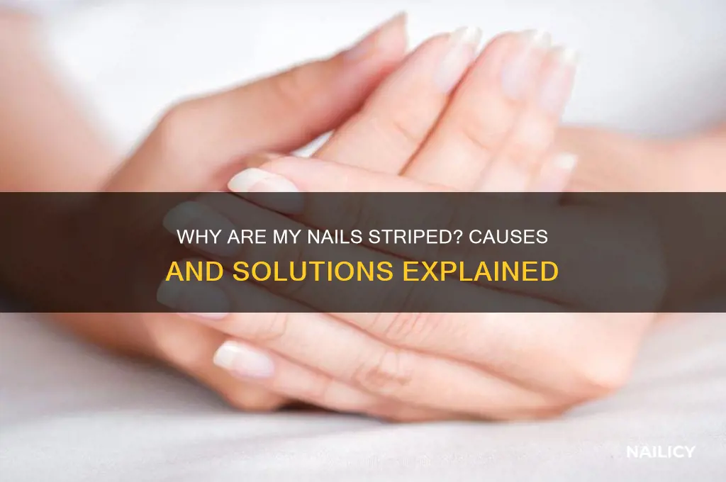 why are my nails striped