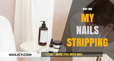 Why Are My Nails Stripping? Causes and Solutions for Weak Nails