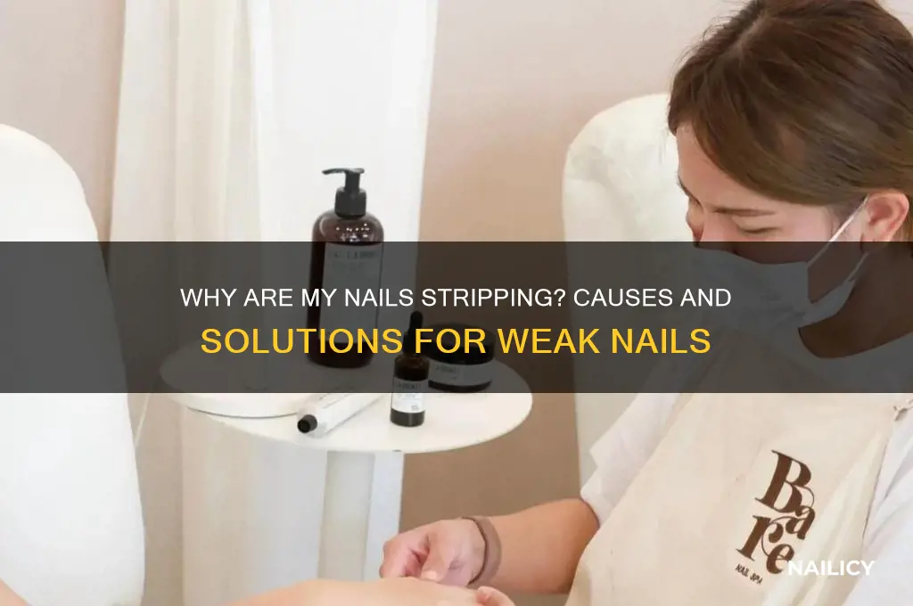 why are my nails stripping