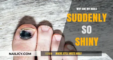 Sudden Nail Shine: Causes and What It Means for Your Health