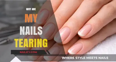 Why Are My Nails Tearing? Causes and Solutions for Brittle Nails