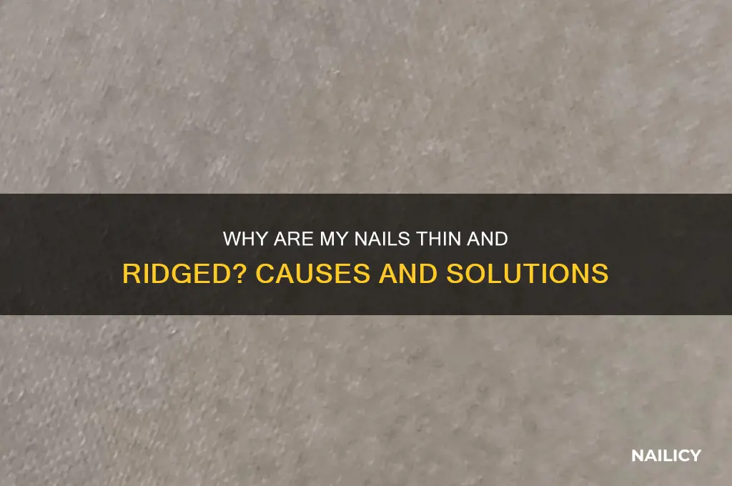 why are my nails thin and ridged