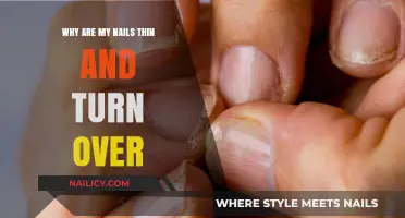 Why Are My Nails Thin and Peeling? Causes and Solutions