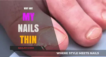 Why Are My Nails Thin? Causes, Prevention, and Effective Solutions