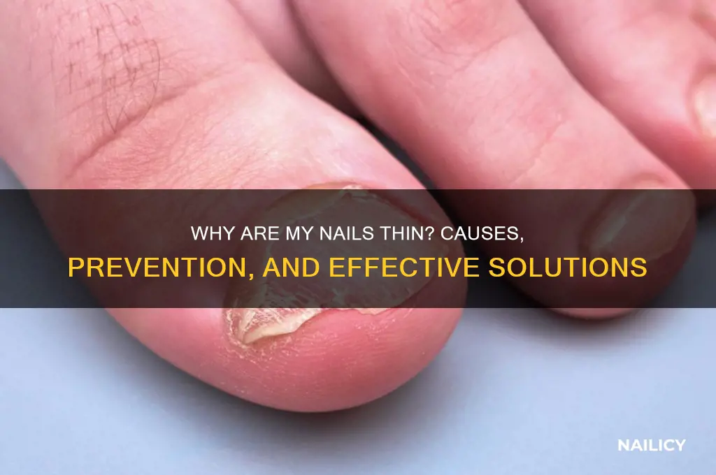why are my nails thin
