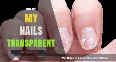 Transparent Nails Explained: Causes and Solutions for Clear Nail Concerns