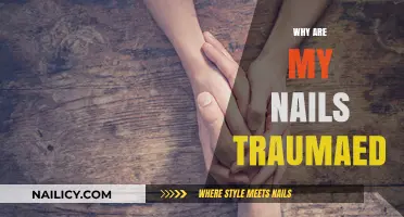 Understanding Traumaed Nails: Causes, Prevention, and Effective Healing Tips
