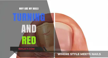 Why Are My Nails Turning Red? Causes and Solutions Explained