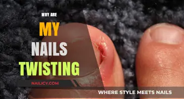 Twisted Nails: Causes, Concerns, and Solutions for Nail Distortion