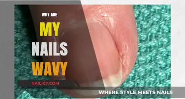 Why Are My Nails Wavy? Causes and Solutions Explained