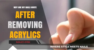 Post-Acrylic Nails: Why the White Appearance?
