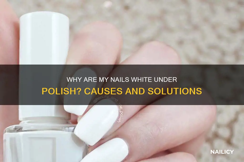 why are my nails white under my polish