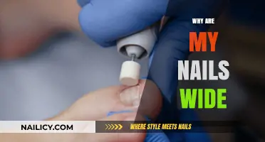 Why Are My Nails Wide? Understanding Causes and Solutions
