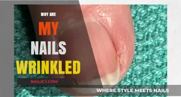 Why Are My Nails Wrinkled? Causes, Prevention, and Solutions Explained