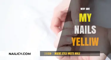 Why Are My Nails Yellow? Causes, Concerns, and Solutions Explained