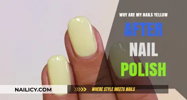 Yellow Nails After Polish: Causes, Prevention, and Solutions Explained