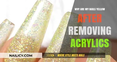 Yellow Nails: Post-Acrylic Side Effects and Solutions