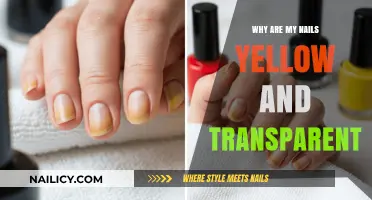 Yellow and Transparent Nails: Causes and Solutions Explained