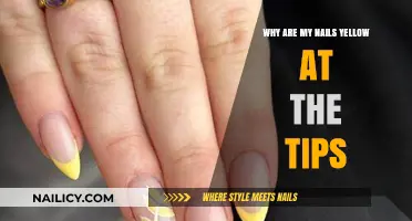 Yellow Nail Tips: Causes, Concerns, and Effective Solutions Explained