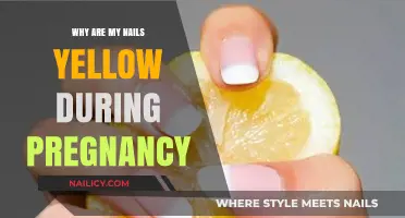 Pregnancy Nail Changes: Understanding Yellow Nails and Their Causes