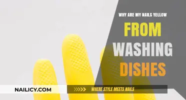Why Dishwashing Turns Nails Yellow: Causes and Solutions Explained
