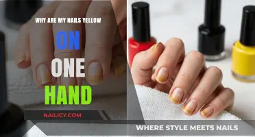 Why Are My Nails Yellow on One Hand? Causes and Solutions
