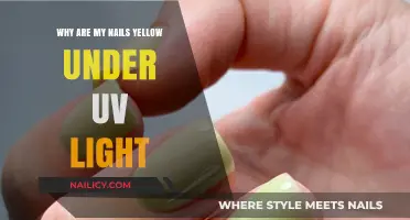 Why Do My Nails Turn Yellow Under UV Light? Explained