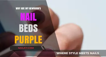 Purple Newborn Nail Beds: Causes, Concerns, and When to Seek Help