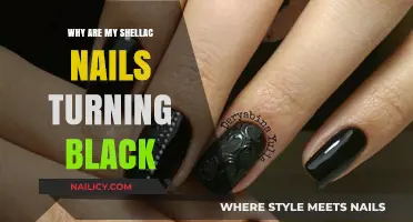 Why Shellac Nails Turn Black: Causes and Prevention Tips