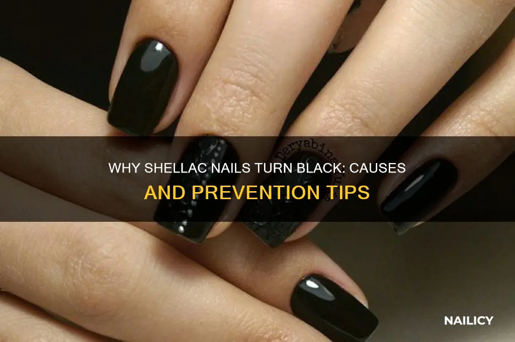 why are my shellac nails turning black